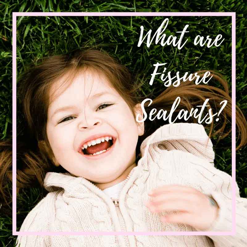 Whatarefissuresealants2