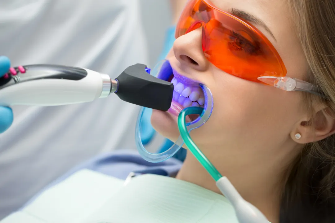 Teeth Whitening Ryde