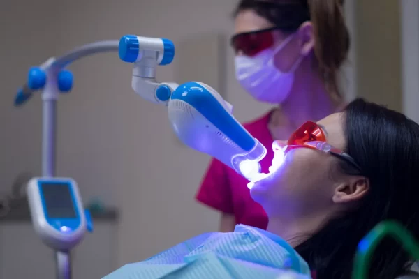 Teeth Whitening Ryde