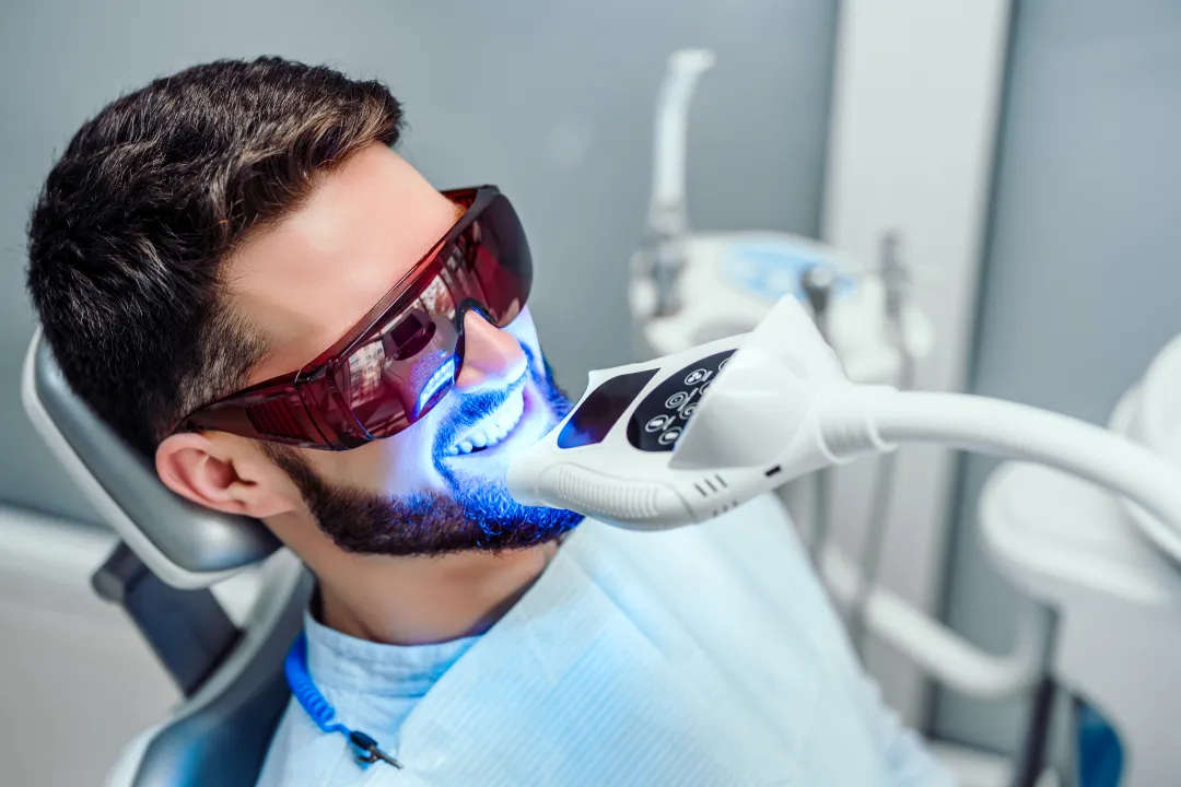 Teeth Whitening Ryde